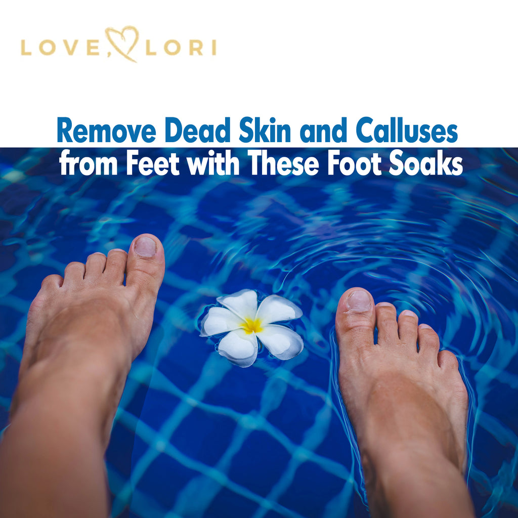 Chemical Foot Peel Removes Crusty Dead Skin and Callus Buildup