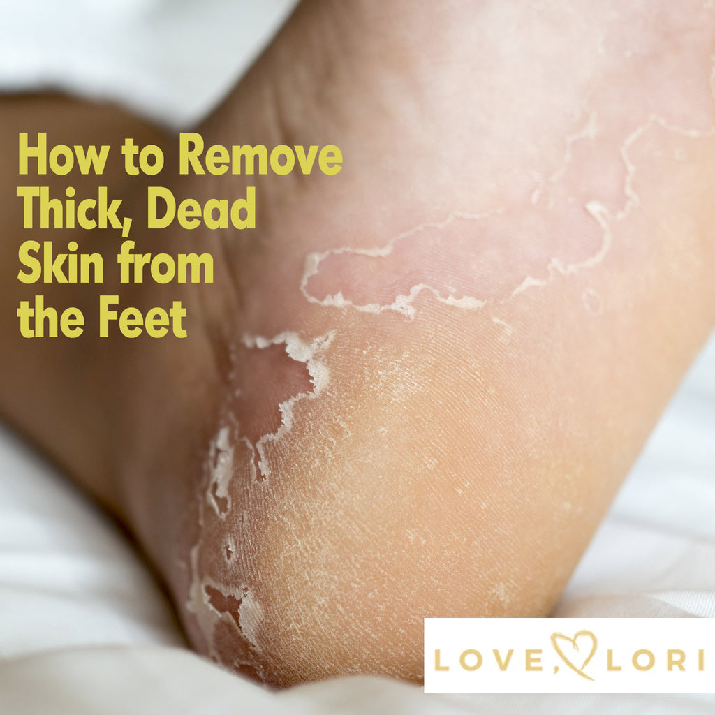 10 Ways To Remove Dead Skin From Your Feet