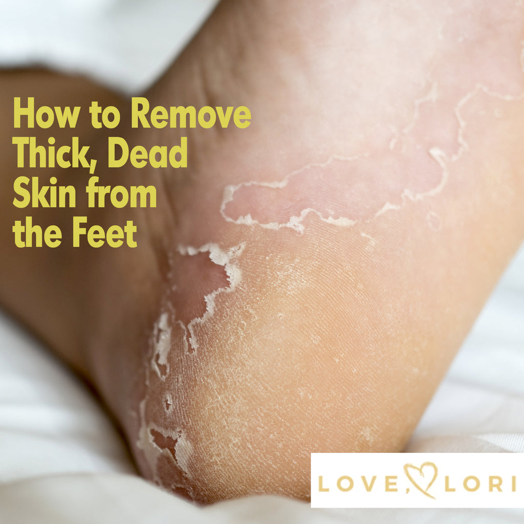 Step-by-step: how to remove dead skin from feet at home