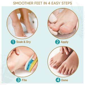 Foot Callus Remover Gel 6oz By Love, Lori - Callus Remover For Feet & Dead Skin Remover For Feet - Works With Foot Scrubber, Pumice Stone For Soft Feet - Professional Pedicure Results At Home