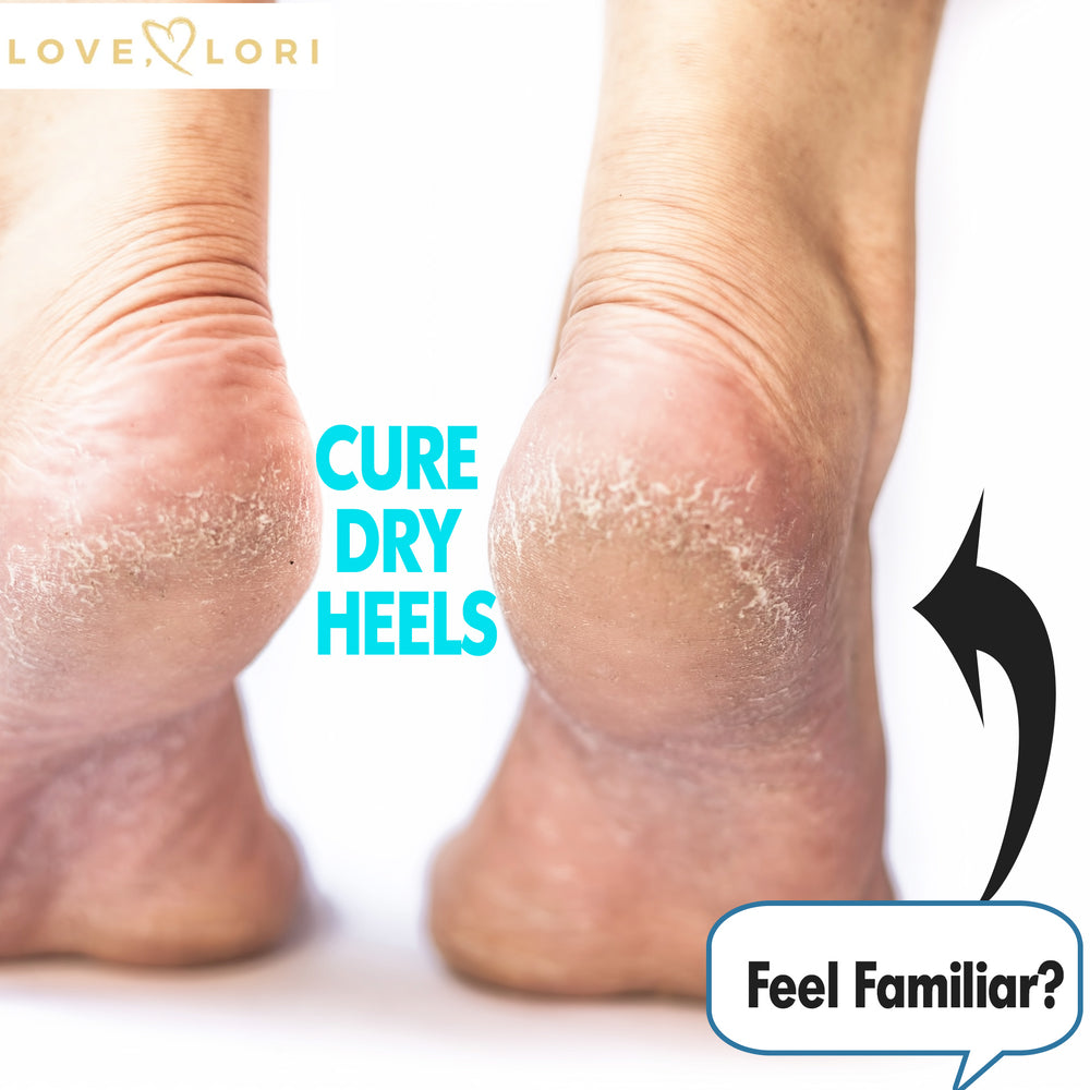 How to Heal Deep Cracked Heels - My Mommy Style