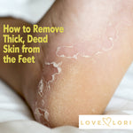 How To Remove Thick Dead Skin From Feet