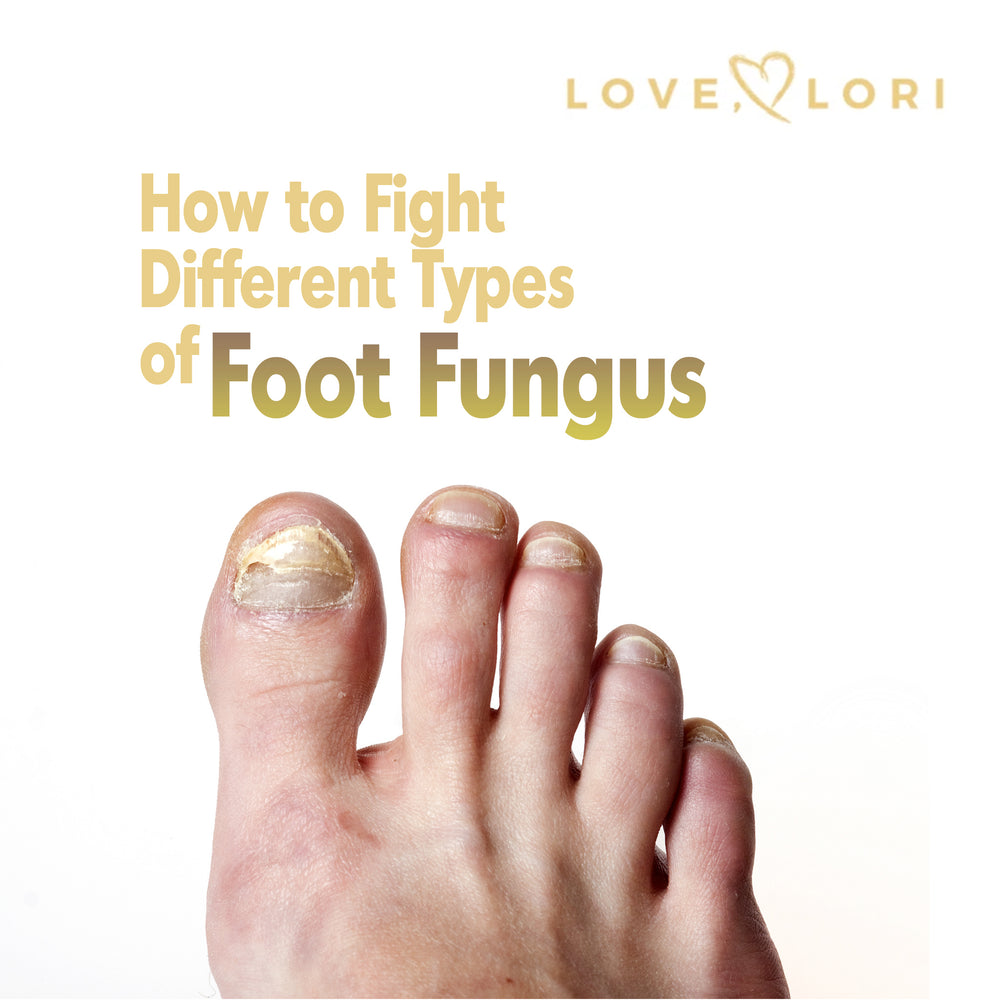 Types Of Foot Fungus And How To Fight Them At Home