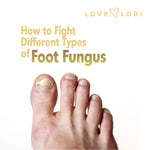 Types Of Foot Fungus And How To Fight Them At Home