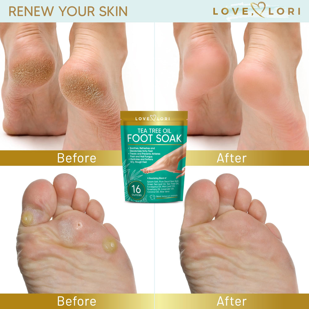 Home pedicure soak for dry cracked feet discount