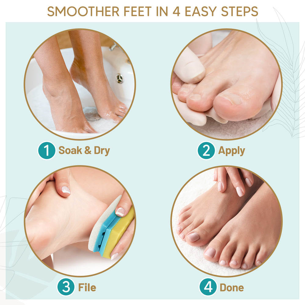 Foot Callus Softener, Callus Remover Spray Moisturizing Foot Care Gel Dead  Skin Horniness Removal BCR120