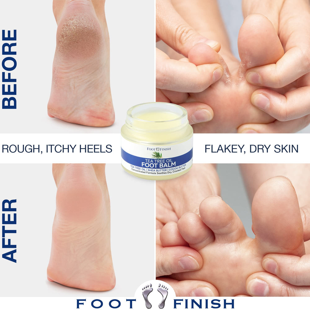 How to get rid of dry skin on feet: Causes and treatment - mamabella