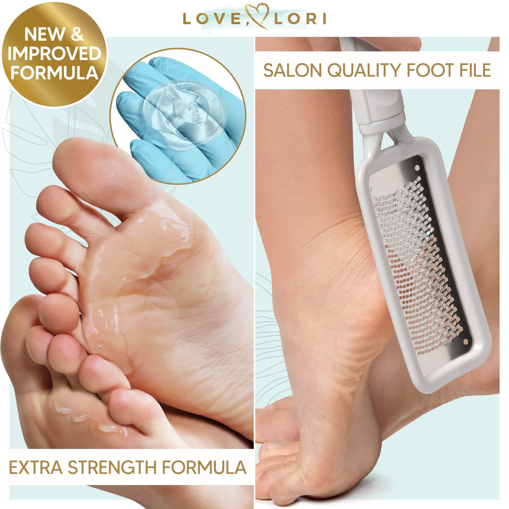 Love Lori Callus Remover for Feet - Foot Spa Kit with Extra Strength Callus Remover Gel, Salon Foot File Rasp and Gloves - Professional Foot Scrubber Dead Skin Remover at Home Pedicure Tools
