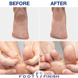 Foot Finish Foot Repair Cream for Athletes Foot Treatment - 4oz Foot Cream for Dry Cracked Feet - Tea Tree Toenail Treatment - Powerful, Natural Anti Itch Cream with Tea Tree, Rose & Lavender Oil