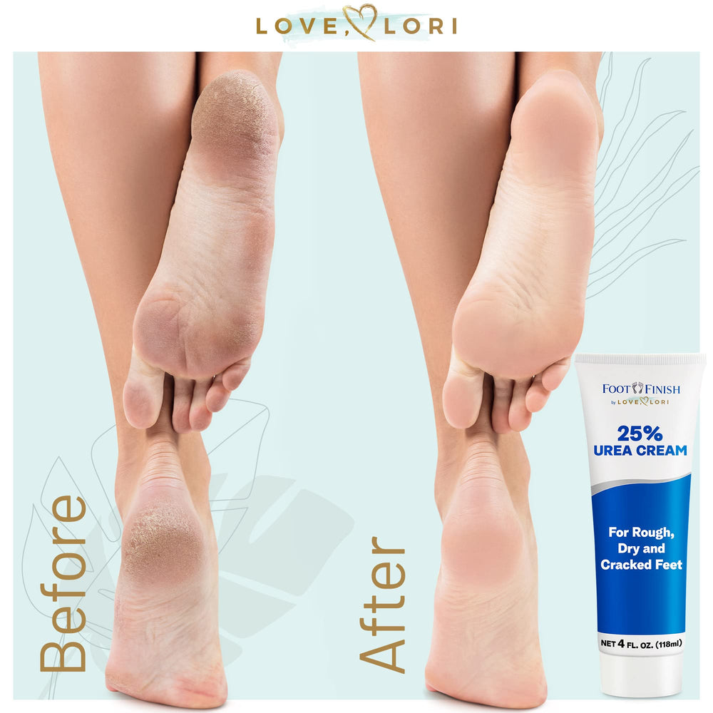 Urea Cream 25% Foot Softening Treatment 4 oz by Love Lori - Foot Cream for Dry Cracked Heels and Hands - Ultra Repair Cream Intense Hydration for Feet, Knees, Elbows - For Rough, Dead & Dry Skin